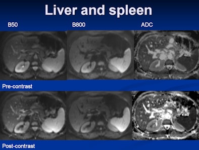 2009 05 15 13 41 36 932 13 Liverand Spleen 394