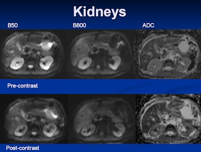 2009 05 15 13 41 37 848 15 Kidneys 394