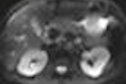2009 05 15 14 01 36 234 15 Kidneys Thumb