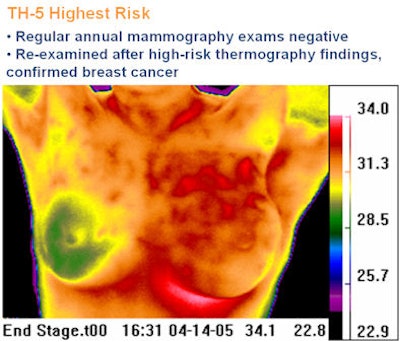 2009 05 19 13 36 09 881 Thermography S2 394