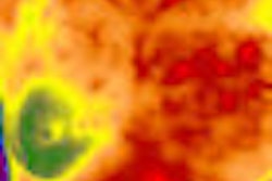 2009 05 19 13 36 10 278 Thermography Thumb