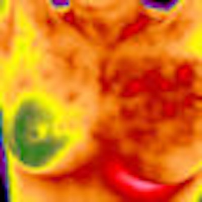 2009 05 19 13 36 10 278 Thermography Thumb