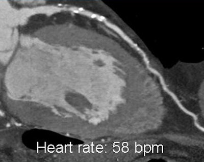 2009 05 19 21 17 44 916 Prokop singlebeat