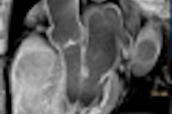 2009 05 19 21 17 55 92 Prokop thumb 05 09