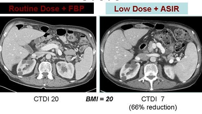 2009 05 21 10 09 36 27 Hara renalcysts
