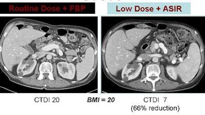 2009 05 21 10 09 36 27 Hara renalcysts
