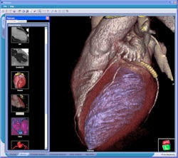 2009 05 28 15 57 14 734 Viatronix 250