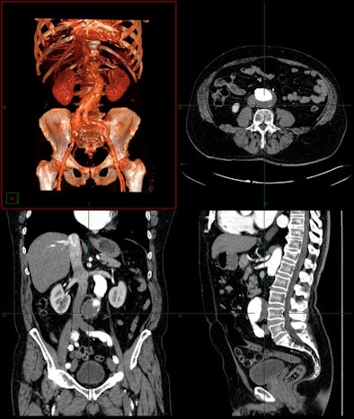 2009 05 28 15 57 16 780 3 D Carestream Health 394