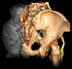 2009 05 28 15 57 17 955 Vital Images 250