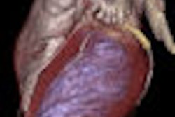 2009 05 28 16 14 58 715 Viatronix Thumb