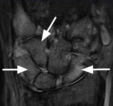 2009 06 05 14 53 25 427 Mr Images01 390 Left