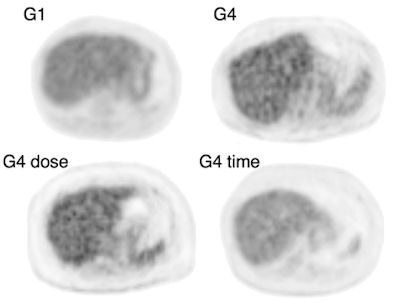 2009 06 09 14 43 17 623 Liver Image 394