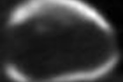 2009 06 16 13 49 46 287 2009 06 17 Le Meunier Cardiac Pet Thumb