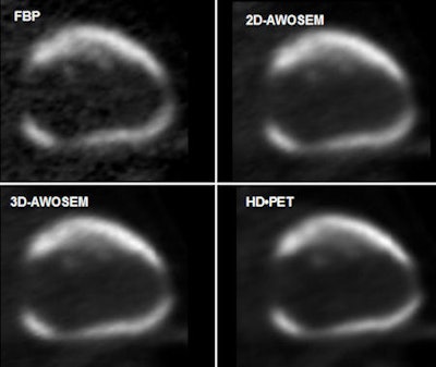 2009 06 16 13 49 46 587 2009 06 17 Le Meunier Cardiac Pet