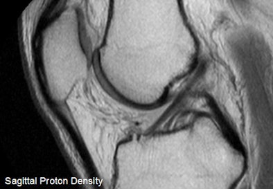 2009 06 23 11 56 31 933 Harsha Acl 394