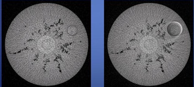 2009 06 26 13 52 25 614 Shaw dualres breasts