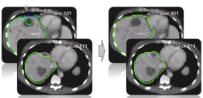 2009 06 30 13 23 16 756 Heckel algorithm results