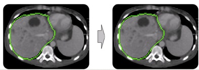 2009 06 30 13 23 18 95 Heckel algorithm2