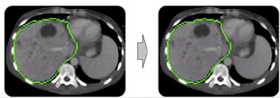 2009 06 30 13 23 18 95 Heckel algorithm2