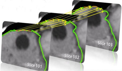 2009 06 30 13 34 52 9 Heckel algorithm1bottom V2