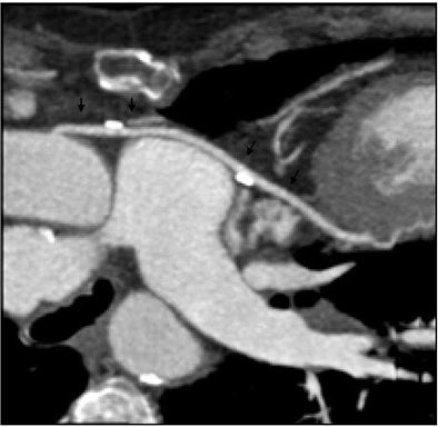 2009 07 06 13 05 16 851 Remyjardin cardiopitch3