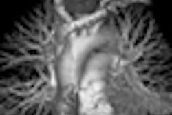 2009 07 06 13 05 17 510 Remyjardin thumb 07 06 09