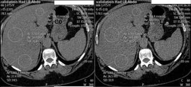 2009 07 07 11 45 58 408 Sosna fattyliver