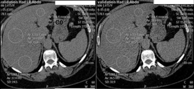 2009 07 07 11 45 58 408 Sosna fattyliver