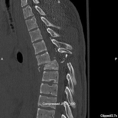 2009 07 07 13 12 43 322 Figure3 A Spine 394