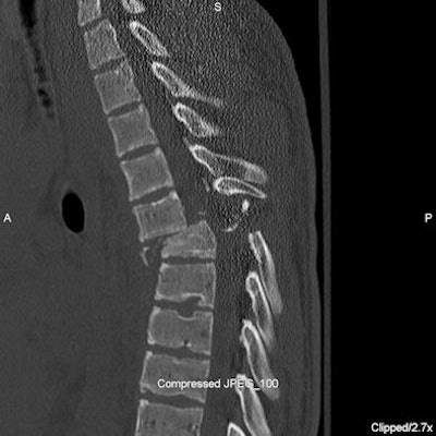 2009 07 07 13 12 43 322 Figure3 A Spine 394