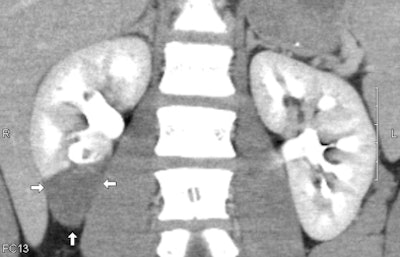 2009 07 07 13 12 44 301 Figure2 Kidney 394