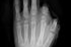 2009 07 07 13 12 45 625 Figure1 Hand Thumb