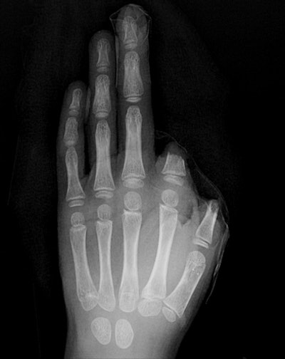 2009 07 07 13 12 48 598 Figure1 Hand 394