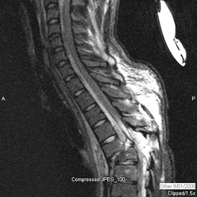 2009 07 07 13 12 48 807 Figure3 B Spine 394