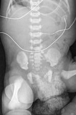 2009 07 14 16 28 07 275 Wet Diaper A 150 V2