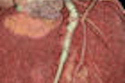 2009 07 17 10 17 28 768 Pontone 74yom bottom Thumb
