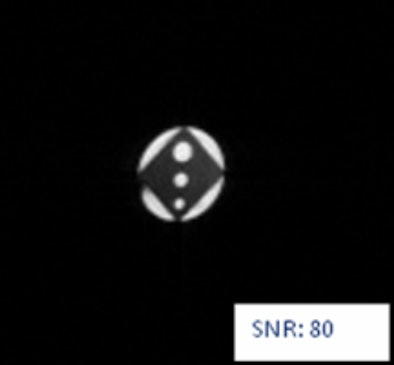 2009 07 27 13 11 03 458 M Rno Linac 394 Top