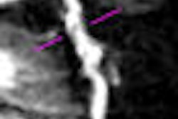 2009 07 29 11 16 21 770 Hacker Image01 Thumb