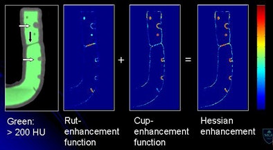 2009 07 28 11 21 11 271 Yoshida morph enhancement middle