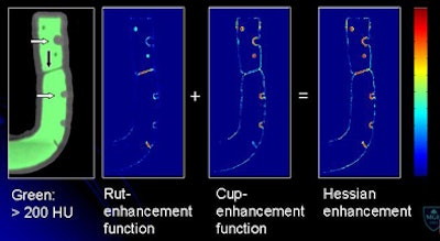 2009 07 28 11 21 11 271 Yoshida morph enhancement middle