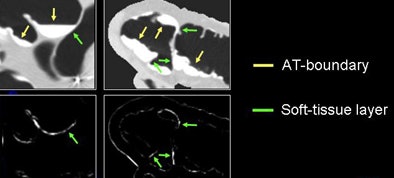 2009 07 28 11 21 17 447 Yoshida localroughness bottom