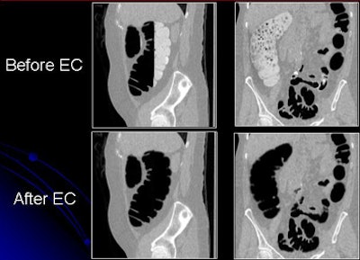 2009 07 28 11 21 22 591 Yoshida beforeafter 2 D top