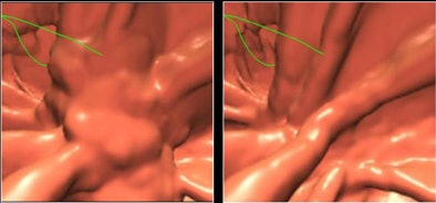 2009 07 28 11 21 24 800 Yoshida beforeafter3 D