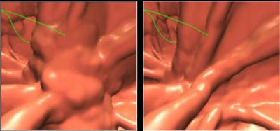 2009 07 28 11 21 24 800 Yoshida beforeafter3 D