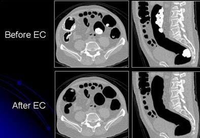 2009 07 28 11 21 26 111 Yoshida beforeafter2 D bottom