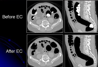 2009 07 28 11 21 26 111 Yoshida beforeafter2 D bottom