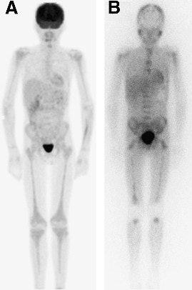 2009 07 31 14 50 20 361 2009 08 03 Neuroblast