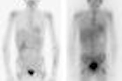 2009 07 31 14 50 21 466 2009 08 03 Neuroblast Thumb