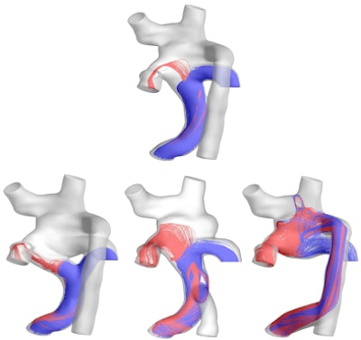 2009 08 11 14 12 00 253 Figure2 Blood Flow Options 394