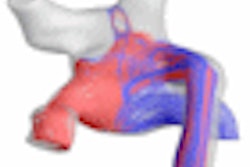 2009 08 11 14 12 00 713 Figure2 Blood Flow Thumb
